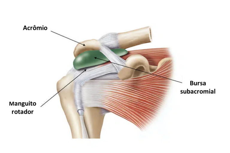 Bursite no ombro: causas, sintomas e tratamento - Avantefisio